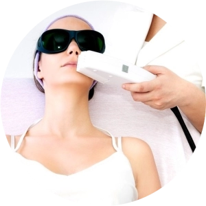 Лазерная эпиляция верхней губы